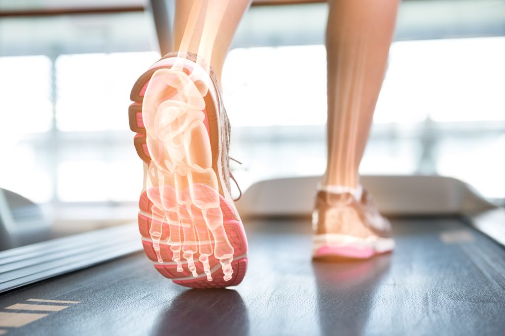 The Many Ways of How to Treat Heel Pain