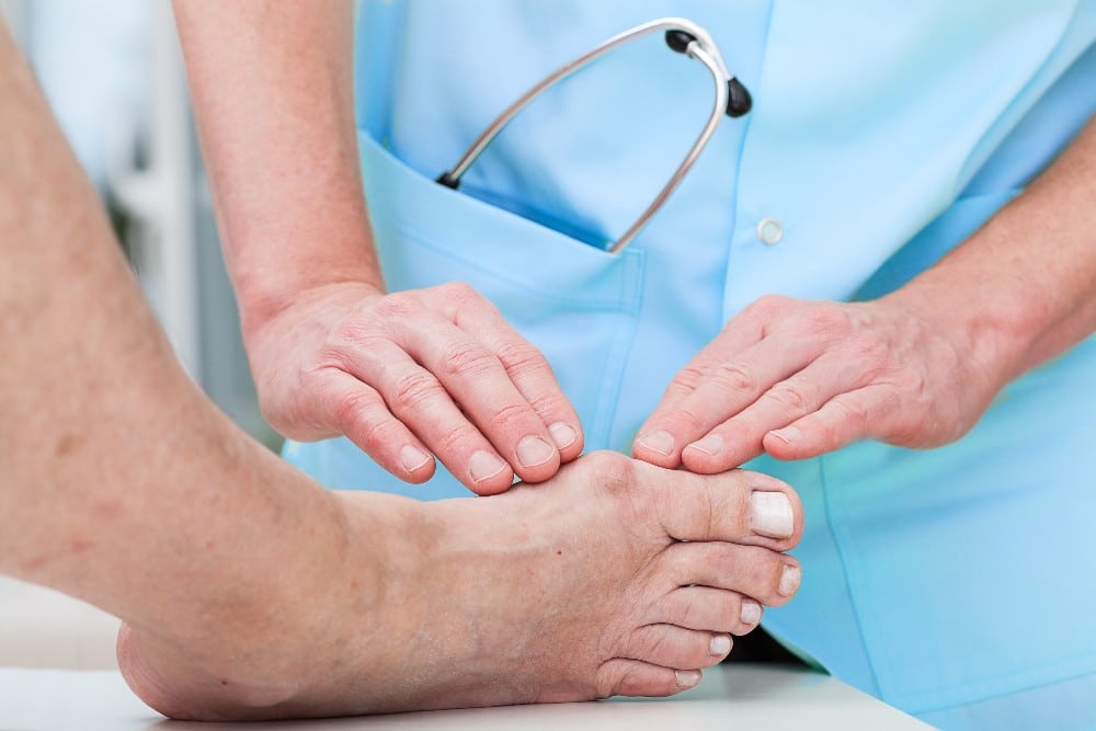 Getting treatment for bunions
