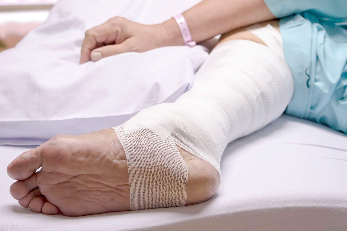 Lower leg and foot with wound care