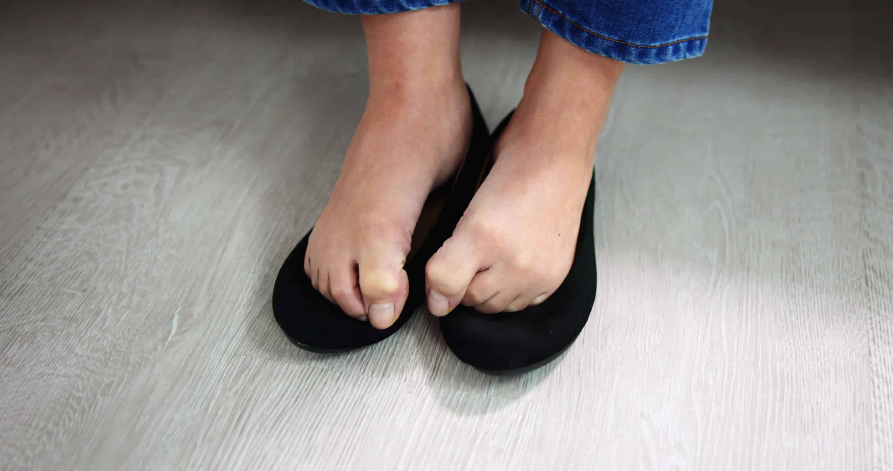 Close-up Of A Woman Sweaty Feet On Shoes Close-up Of A Woman Sweaty Feet On Shoes